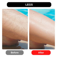 Thumbnail for Hair Eraser Bar - Painless Hair Removal Tool