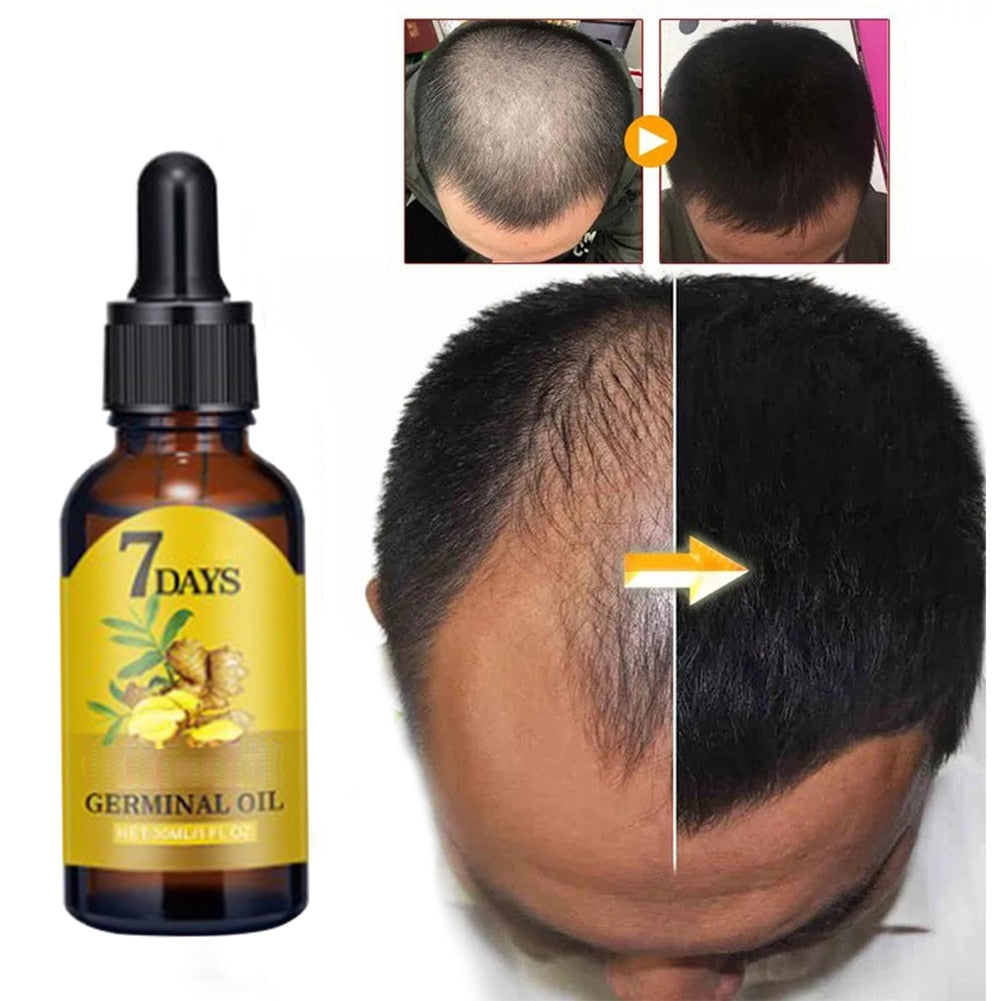 Ginseng Hair Growth Oil 40ml - EELHOE