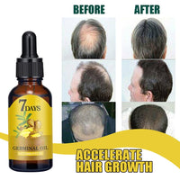 Thumbnail for Ginseng Hair Growth Oil 40ml - EELHOE