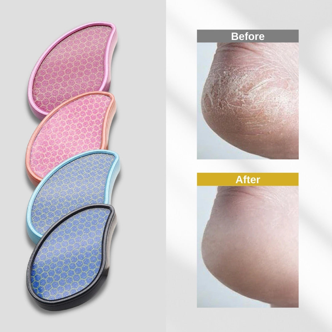 https://thedailygroom.com.au/cdn/shop/products/nano-glass-foot-exfoliator-results-the-daily-groom-beauty-2_1280x.jpg?v=1660808465