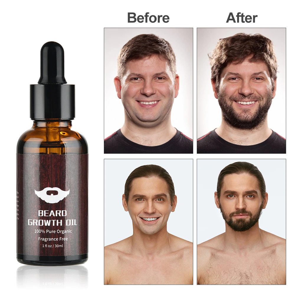 Before and after results of using beard growth oil from The Daily Groom Australia